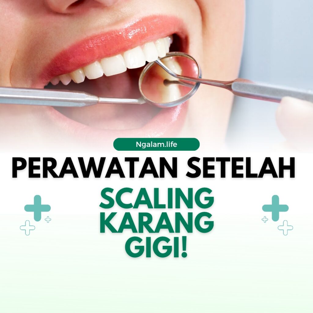 Scalling karang gigi