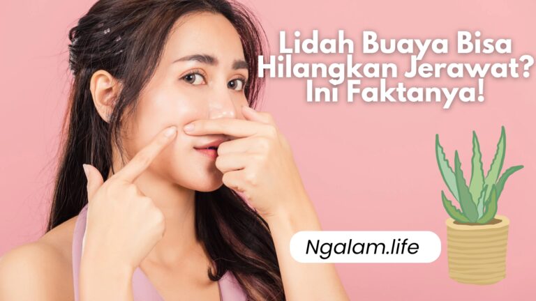 Lidah buaya untuk jerawat